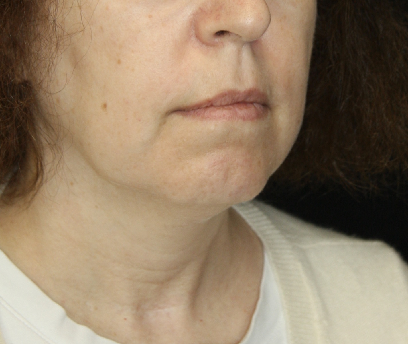 gal-image