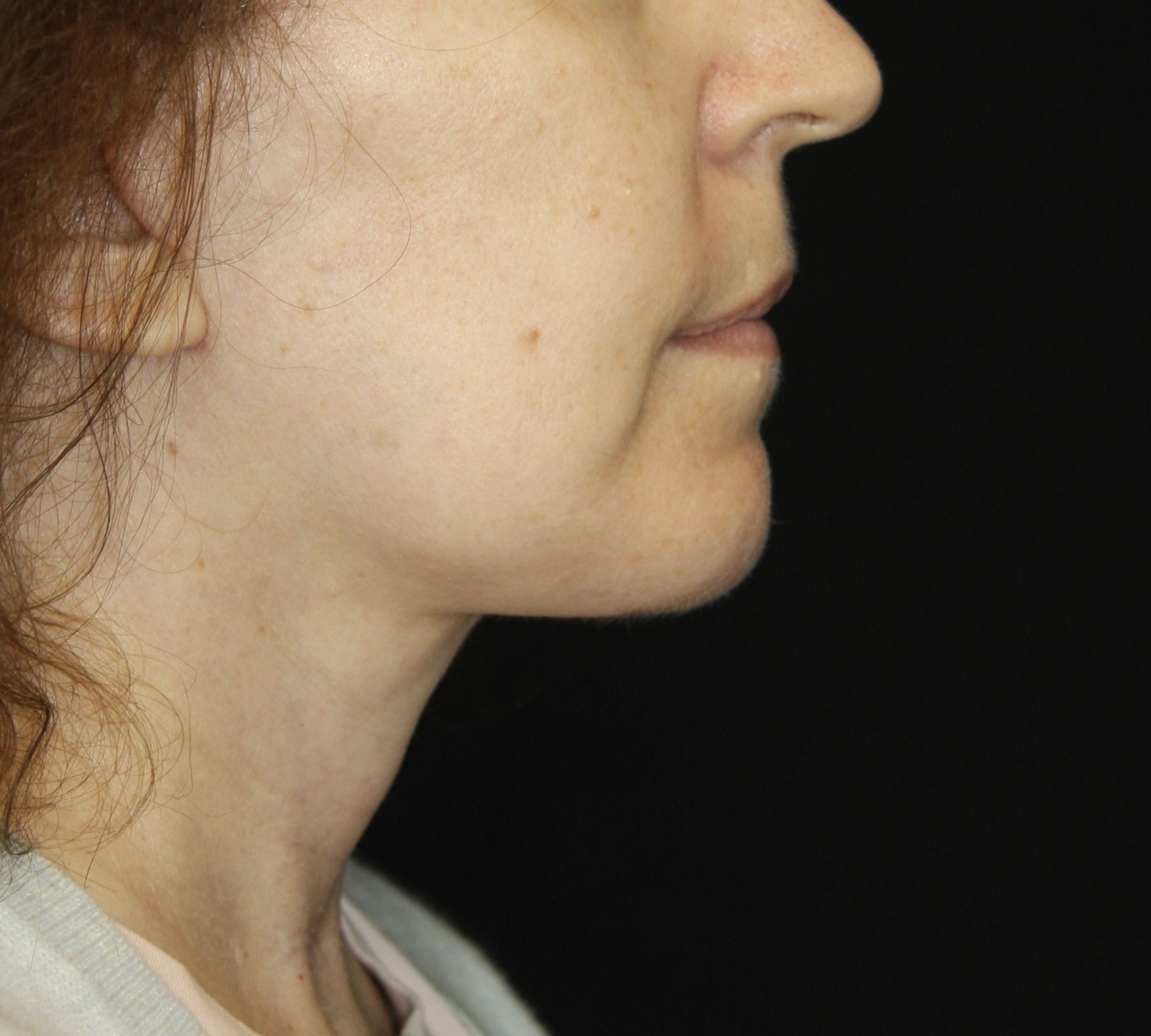 gal-image