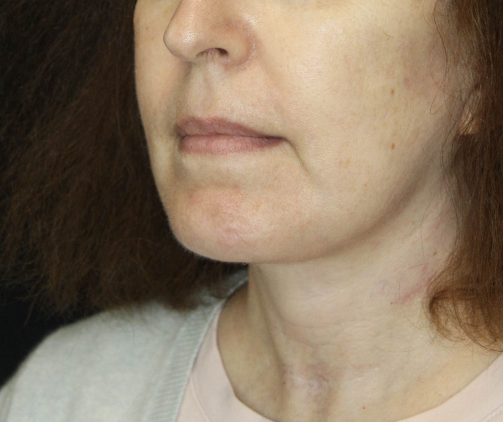 gal-image