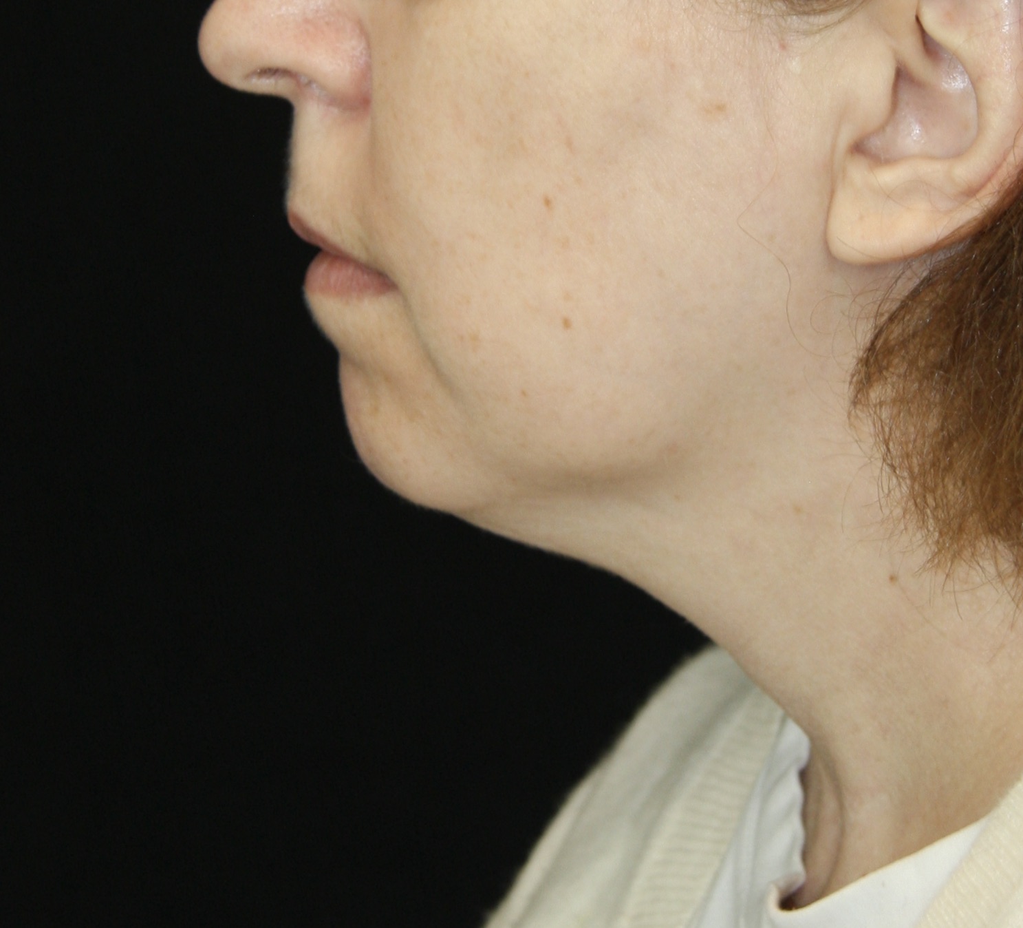 gal-image