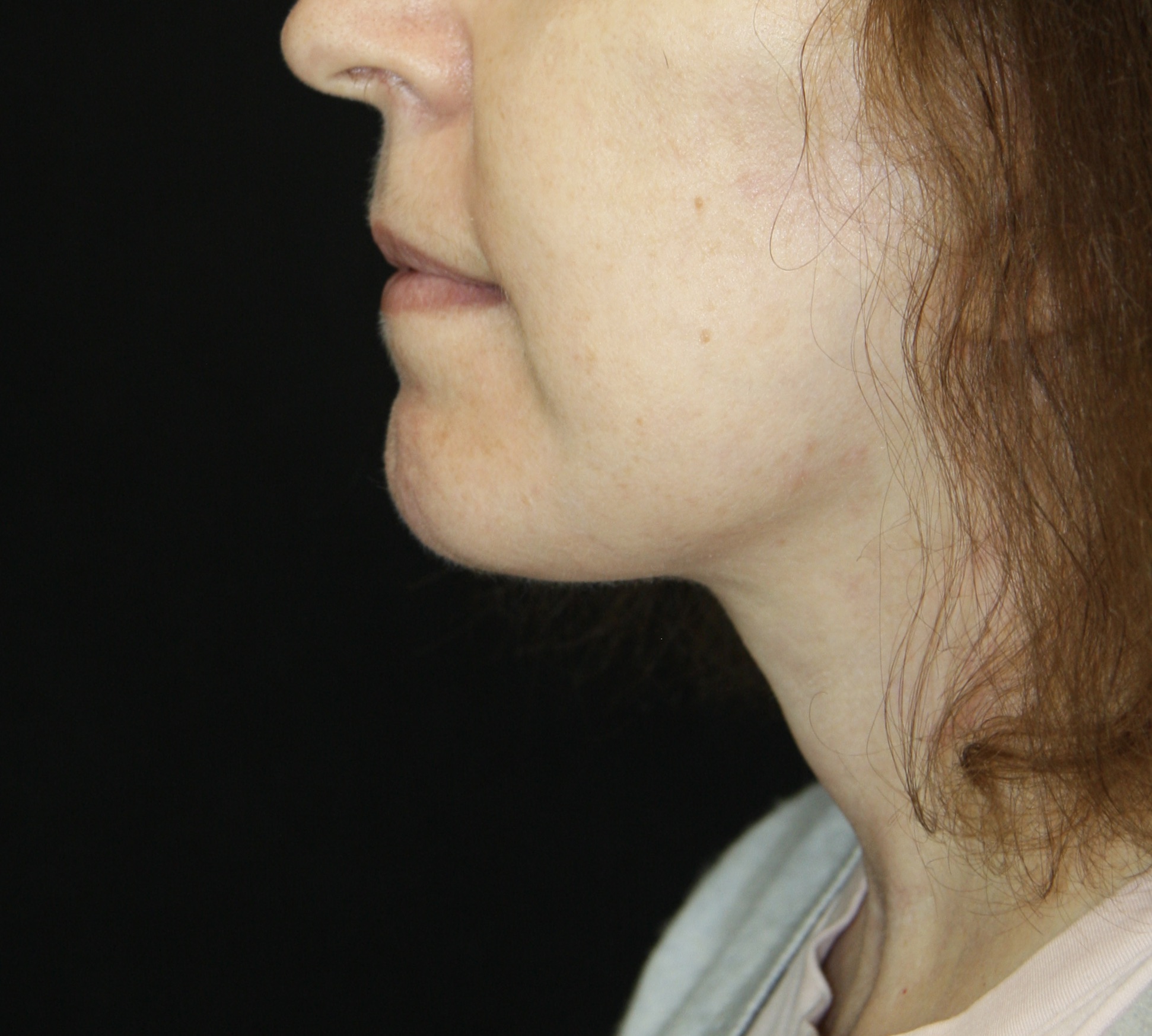 gal-image