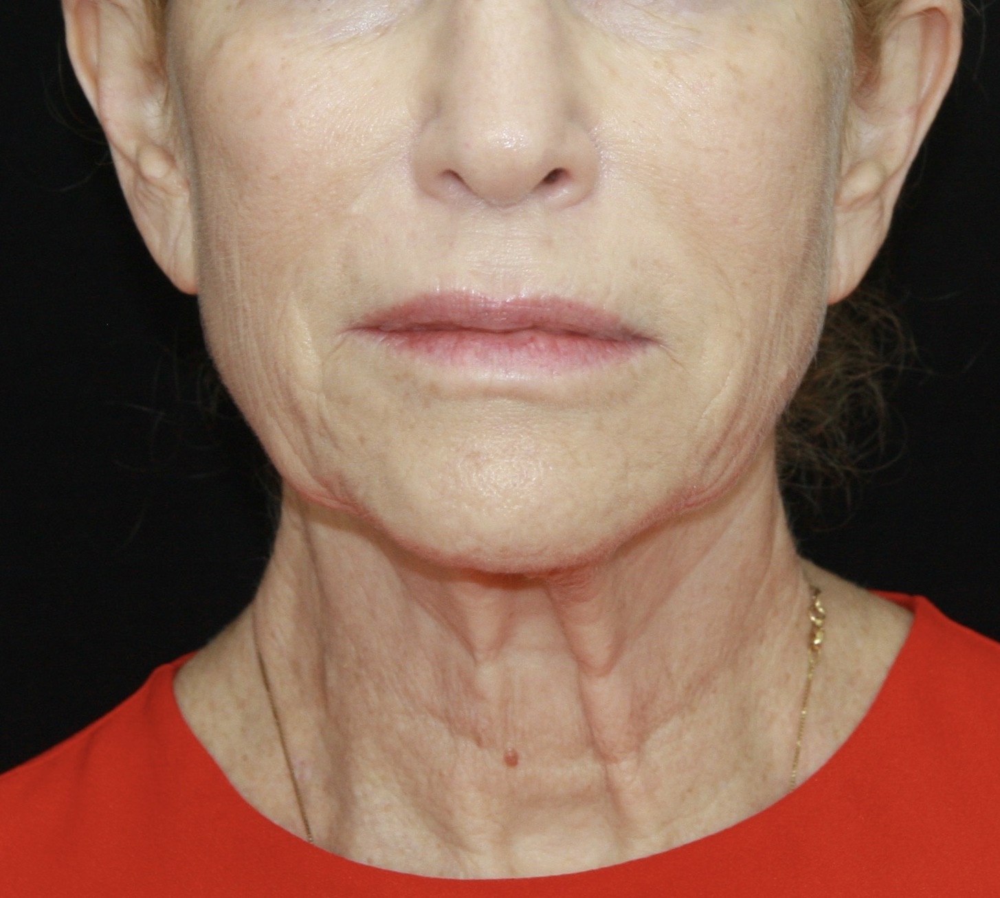 gal-image