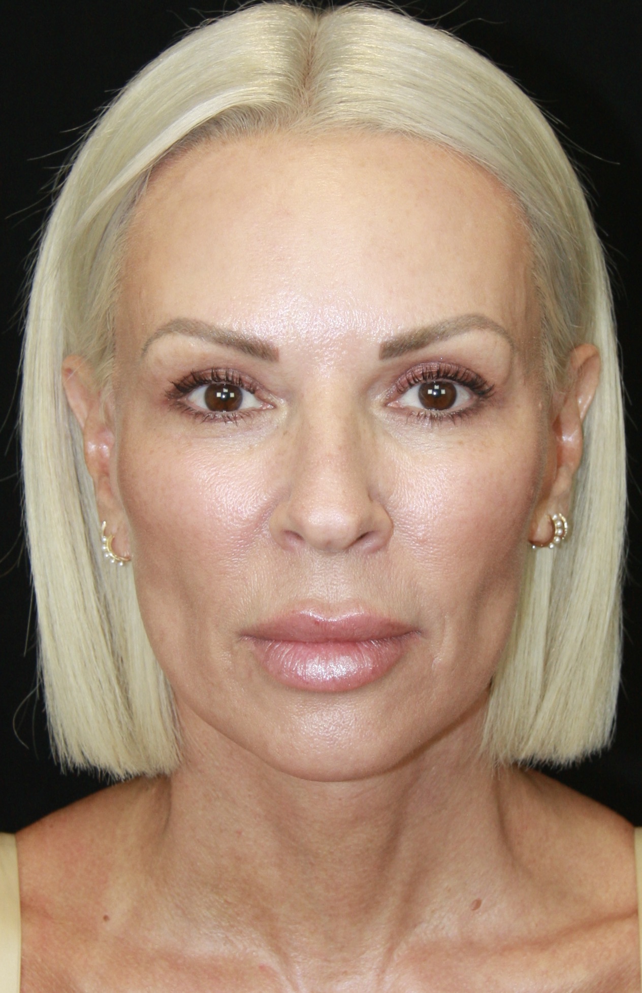 gal-image