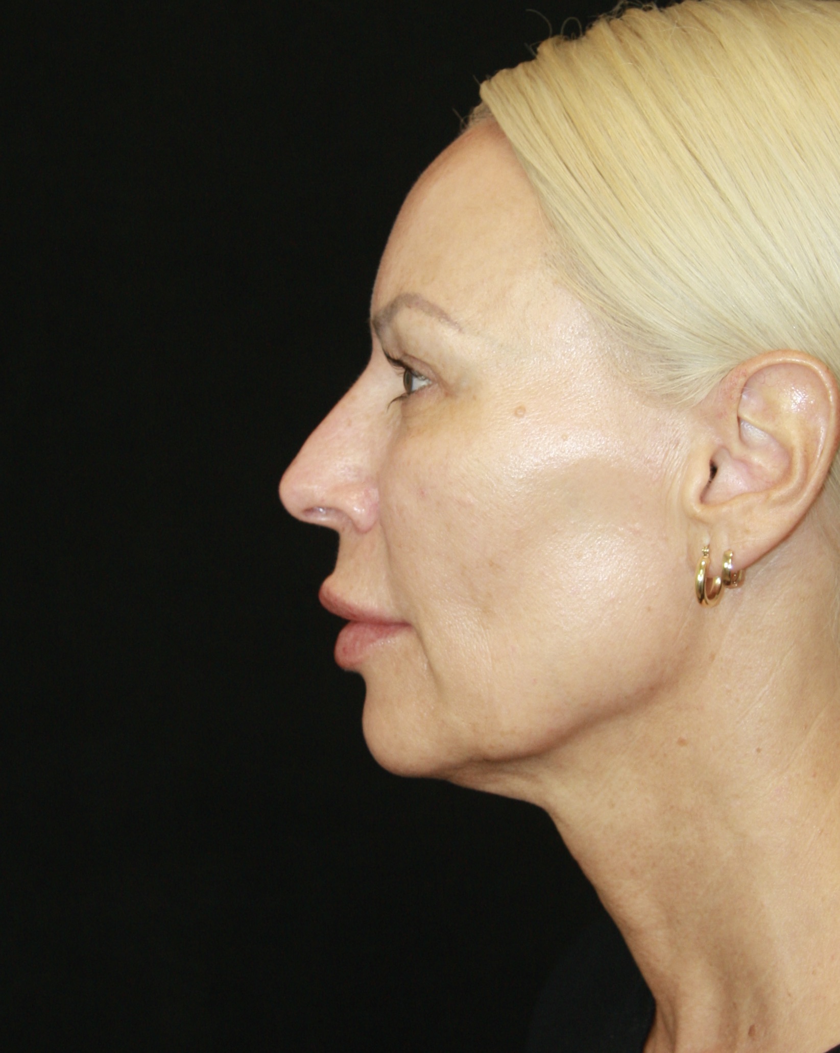 gal-image