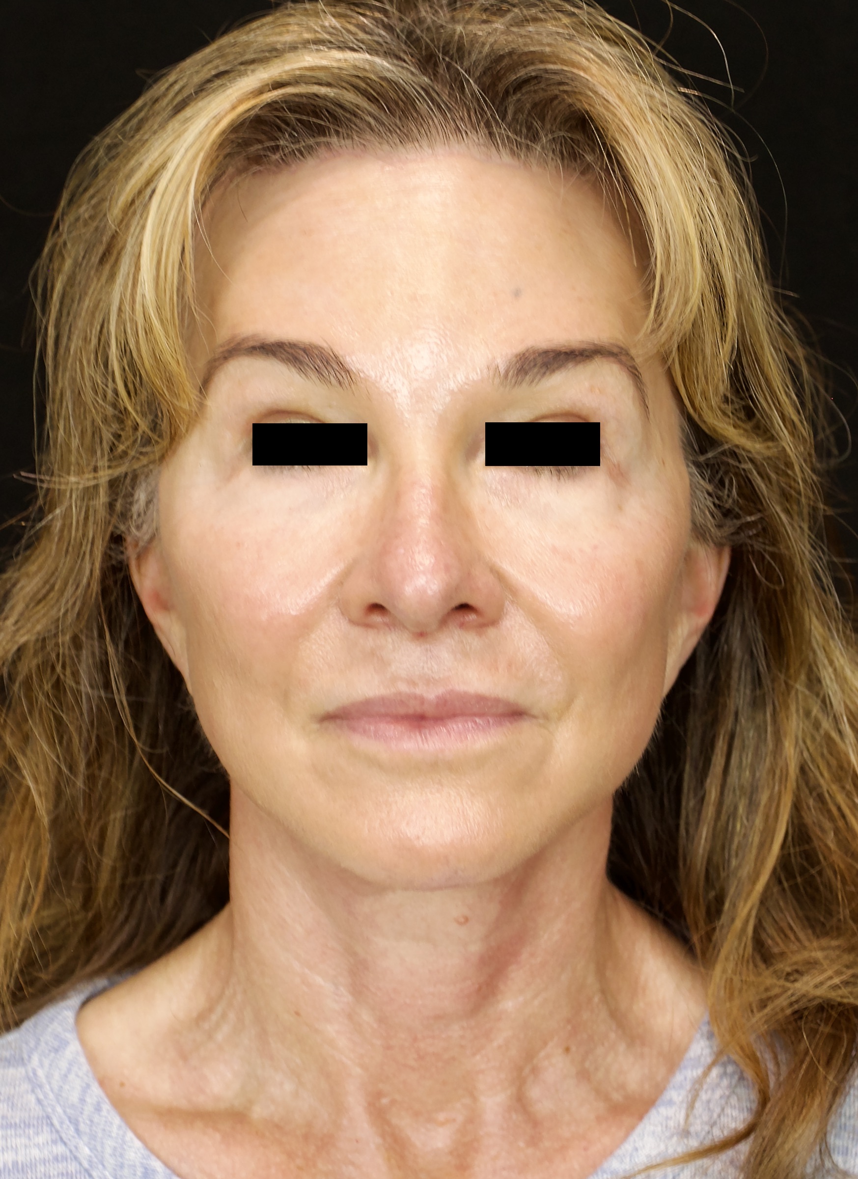 gal-image