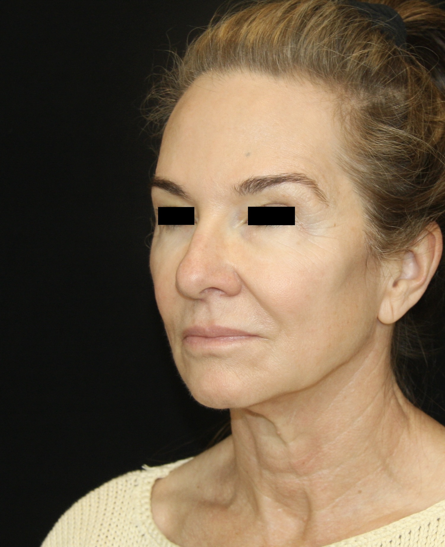 gal-image