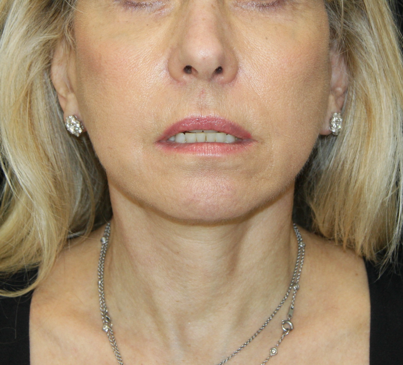 gal-image