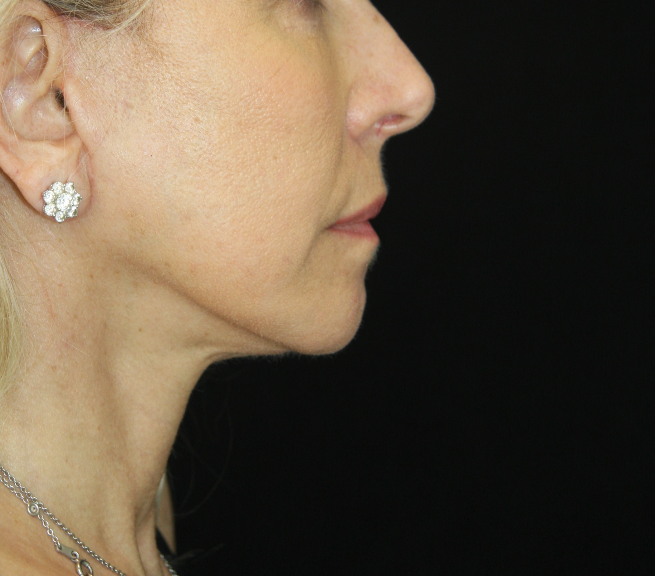 gal-image