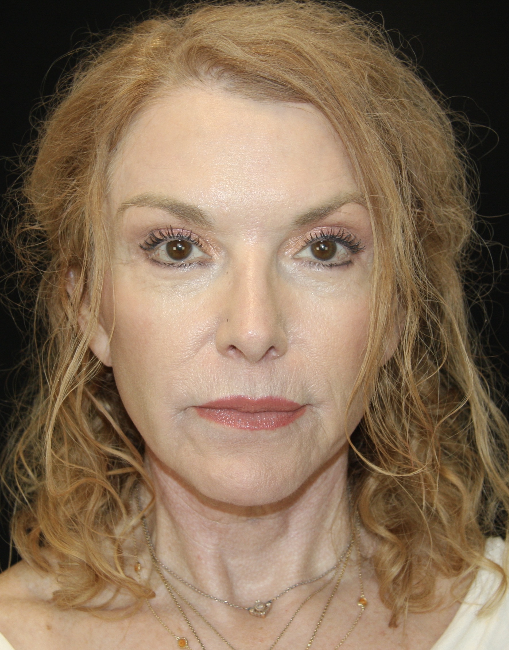 gal-image