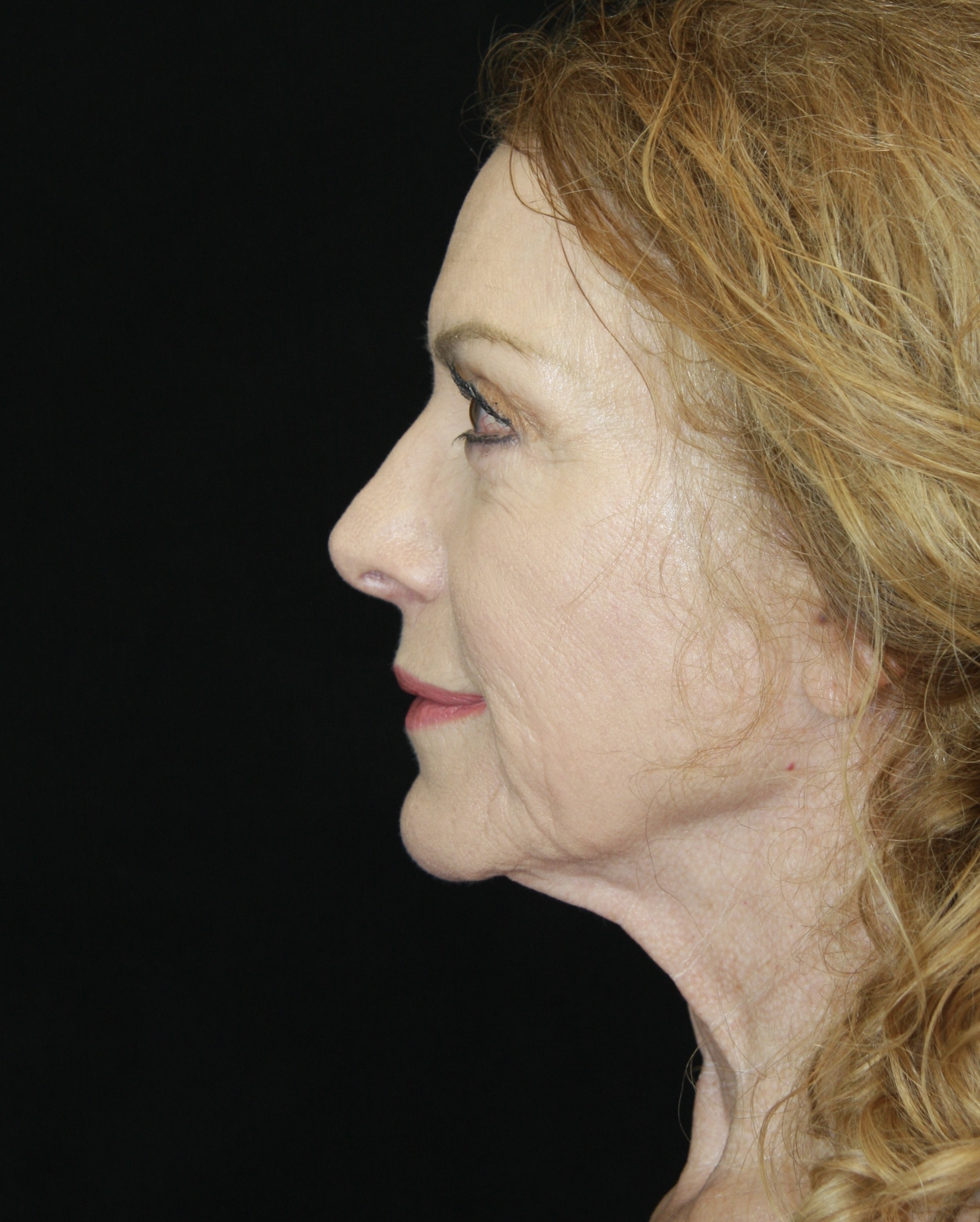 gal-image