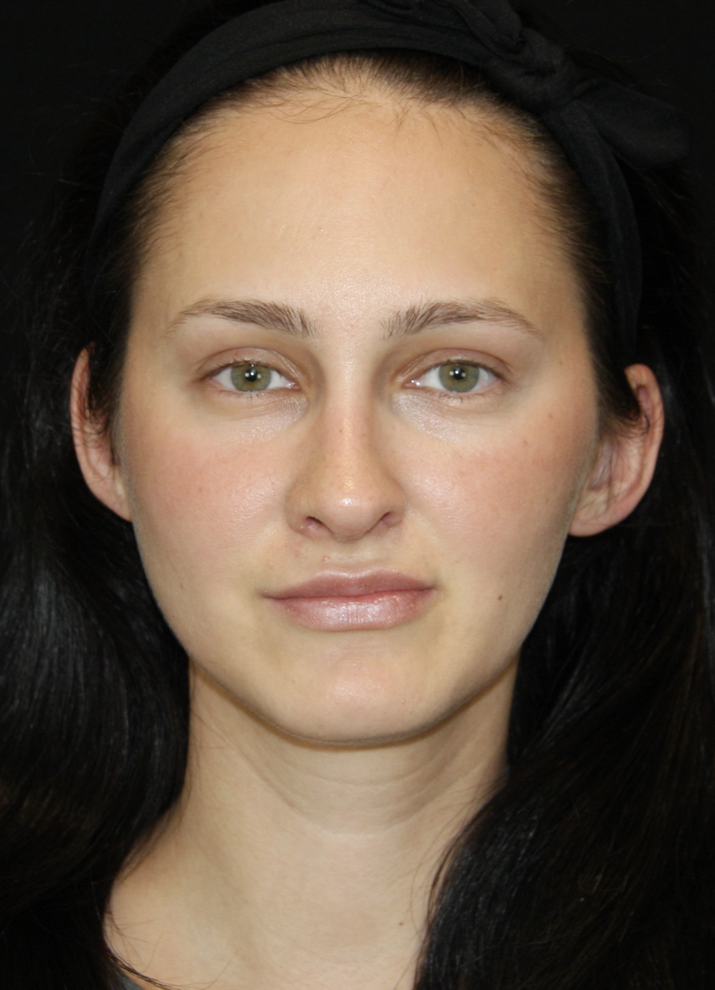 gal-image