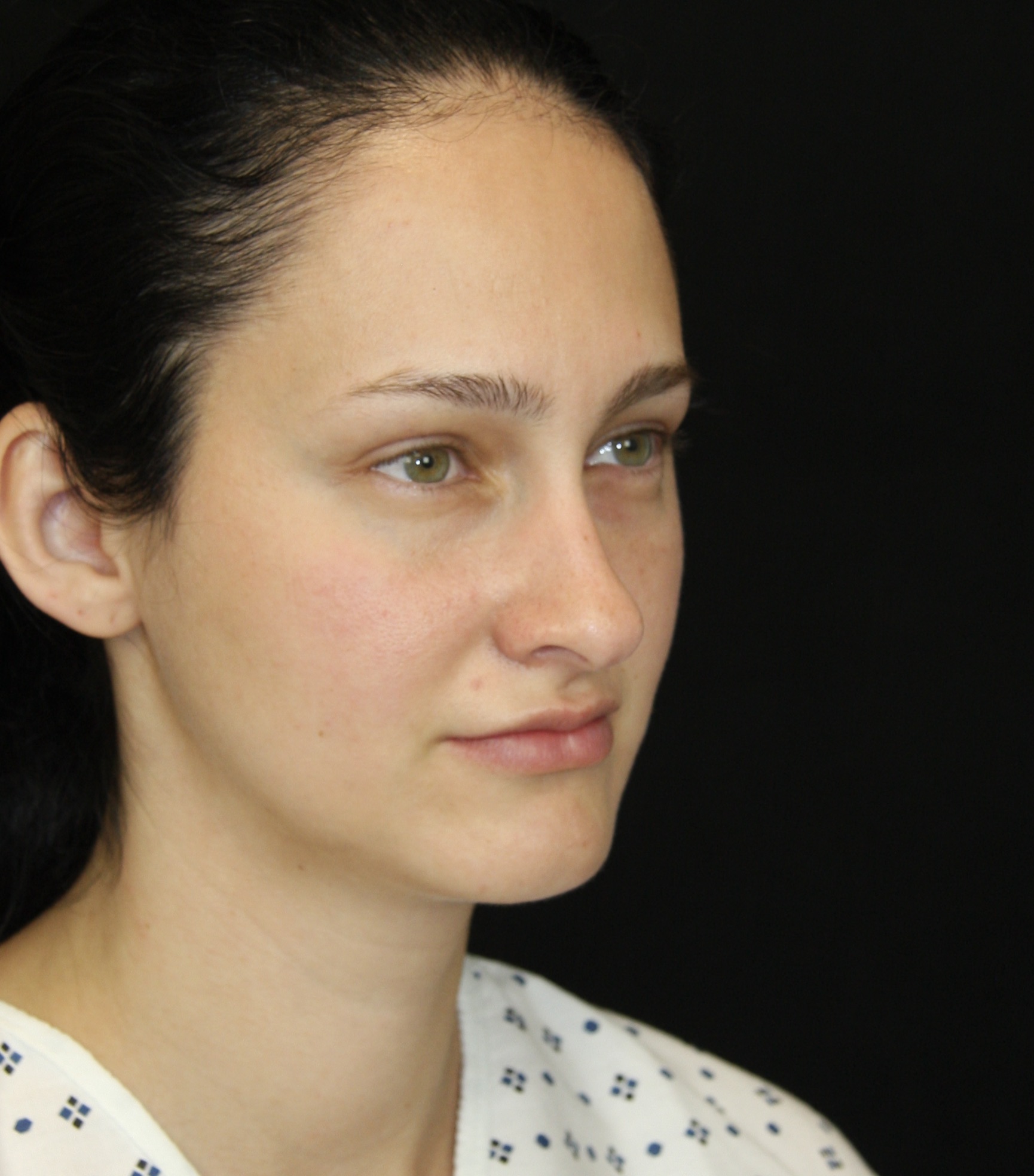 gal-image