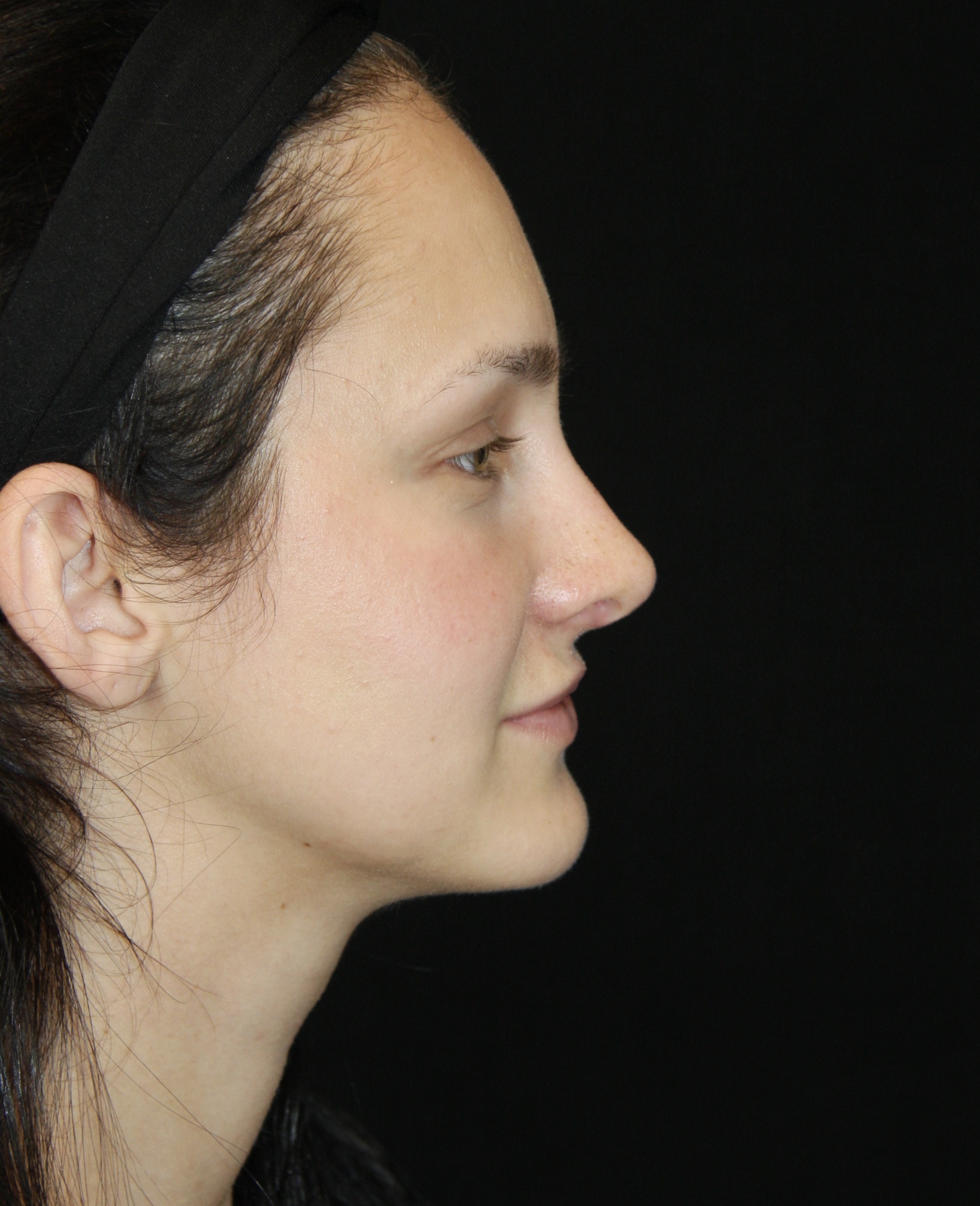 gal-image