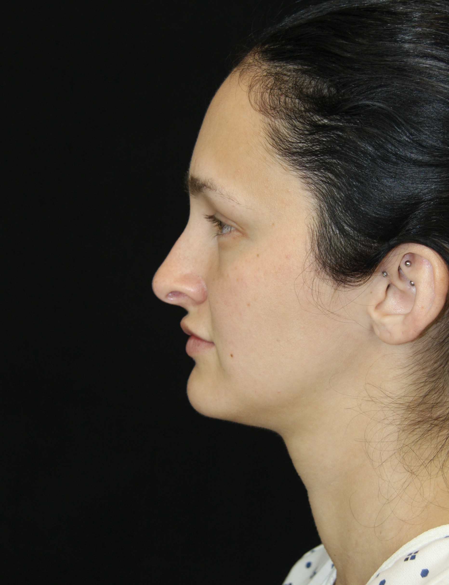 gal-image