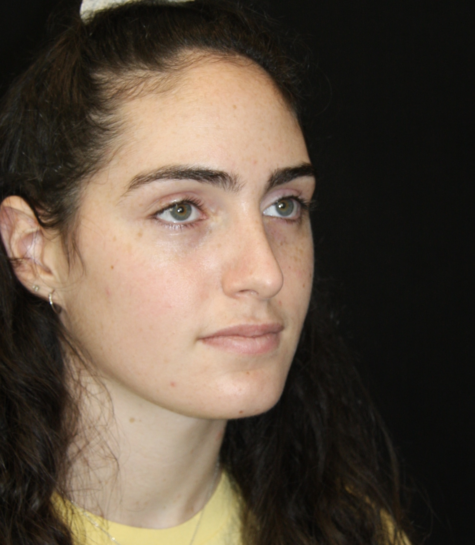 gal-image