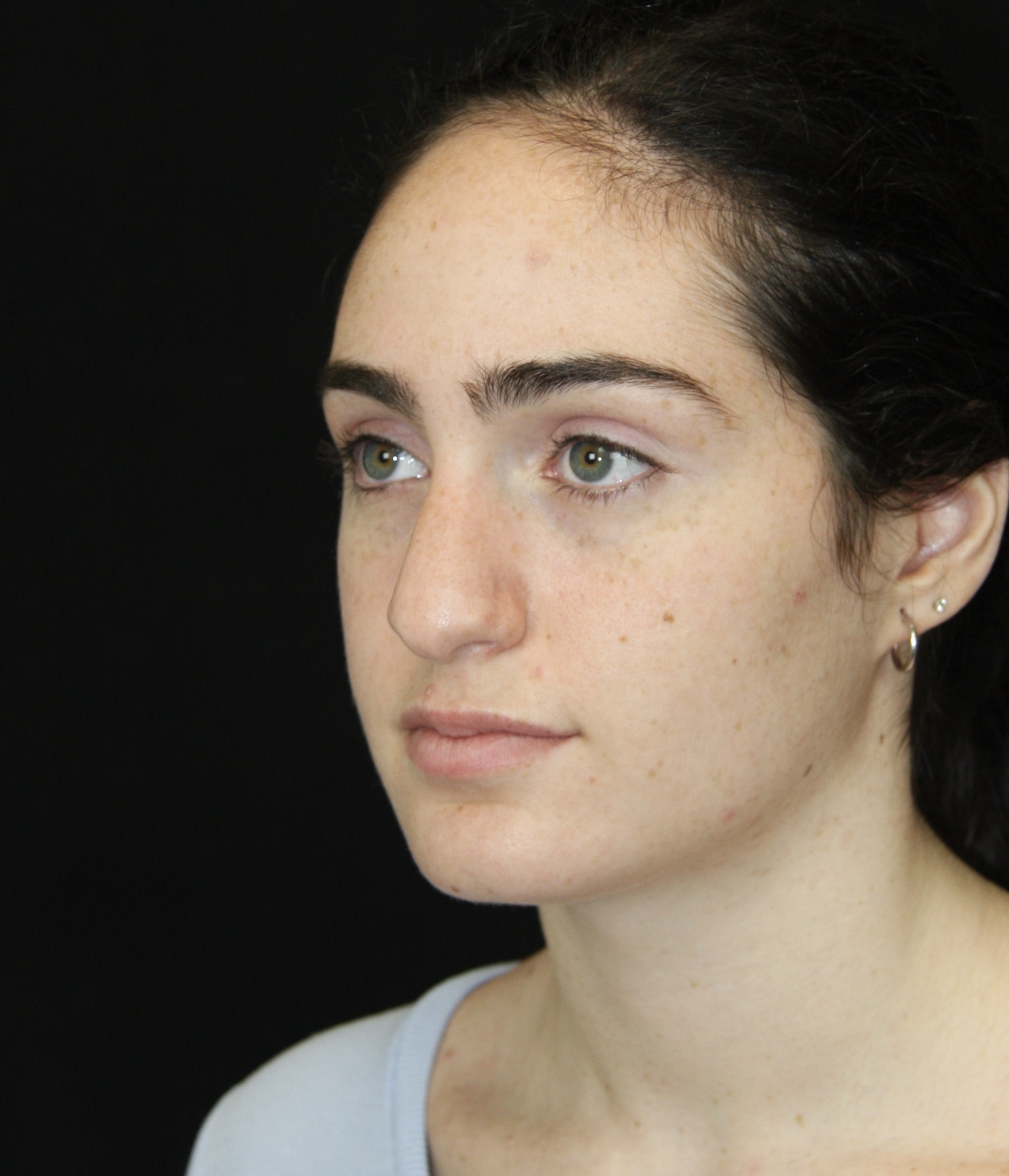 gal-image