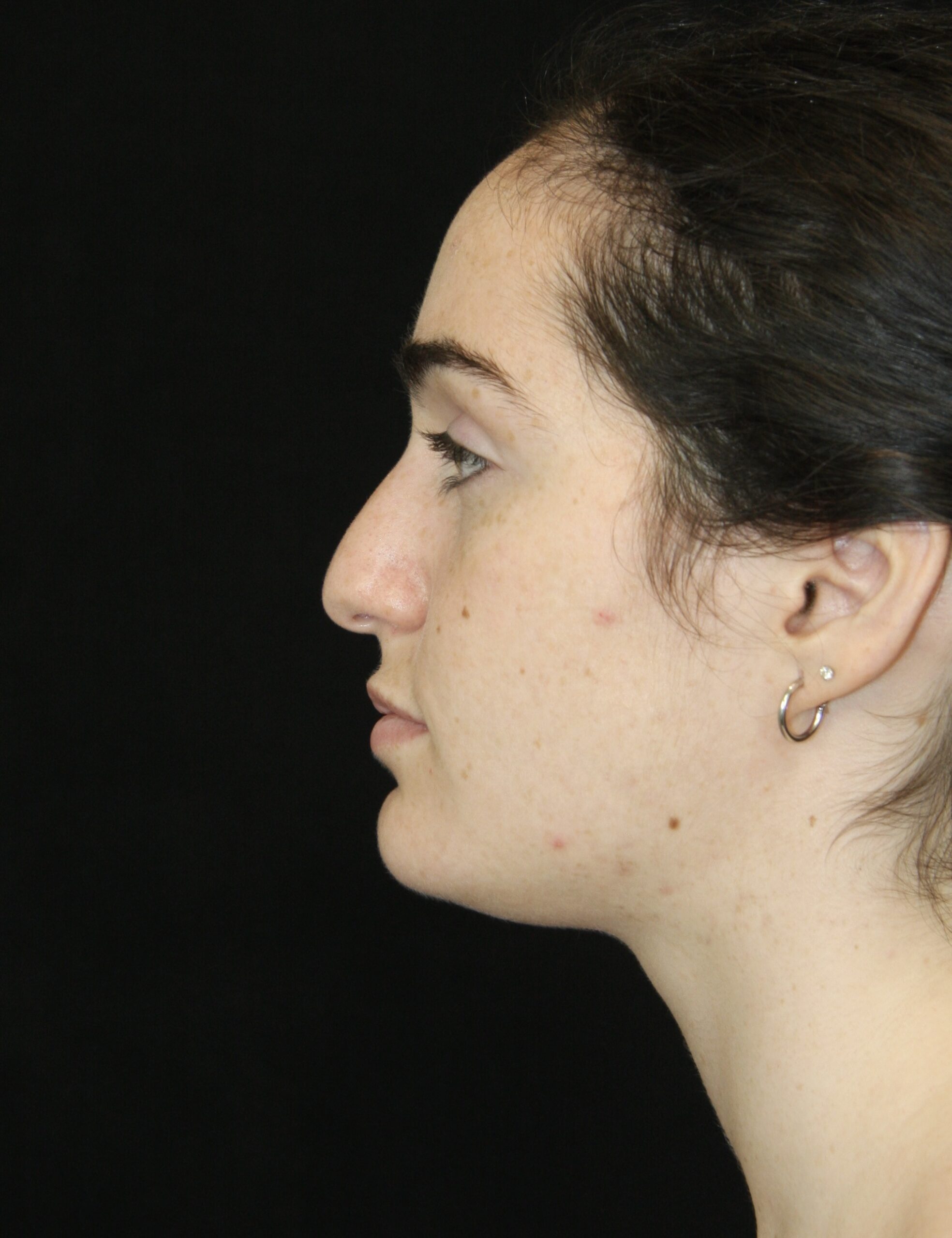 gal-image