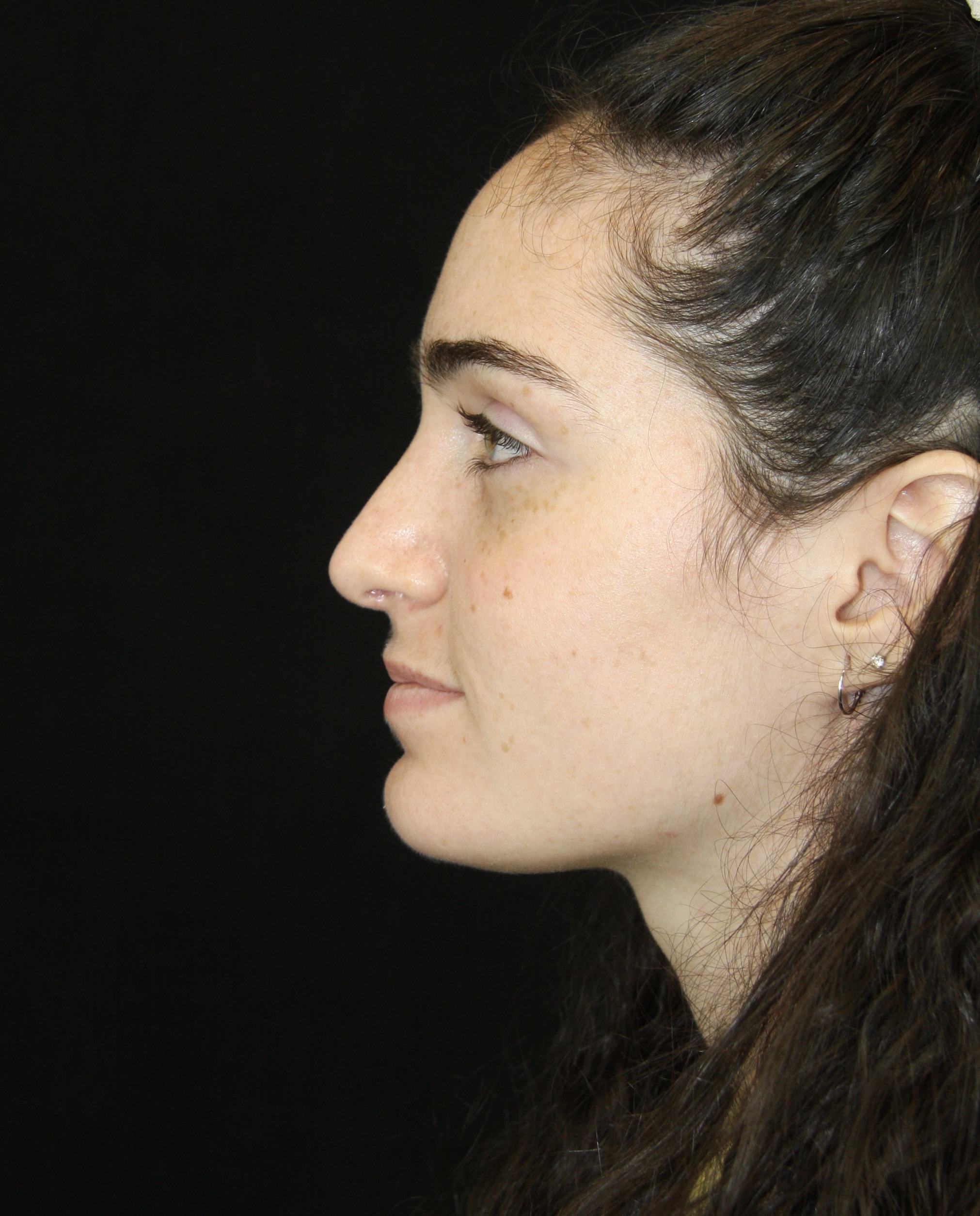 gal-image
