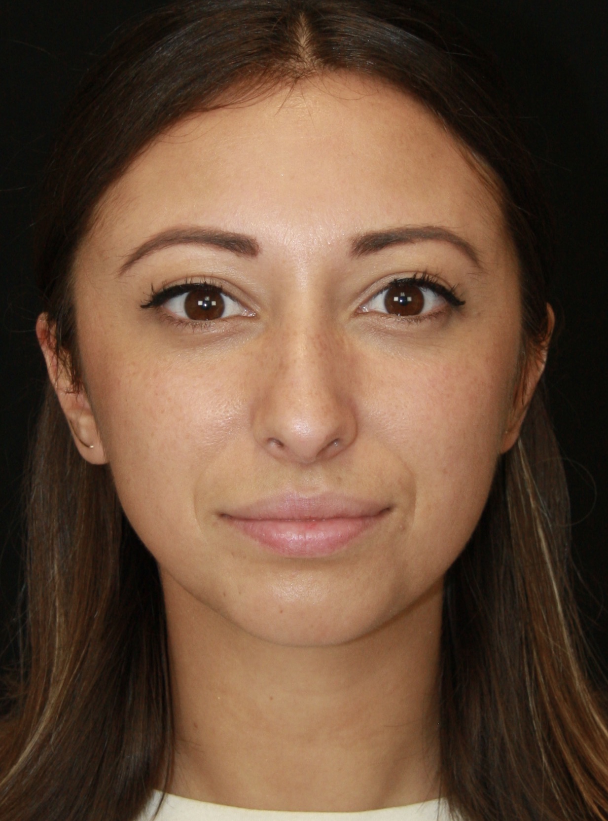 gal-image