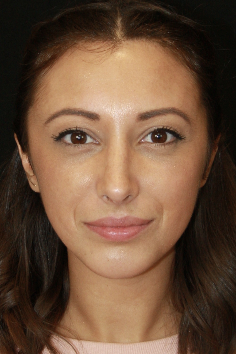 gal-image