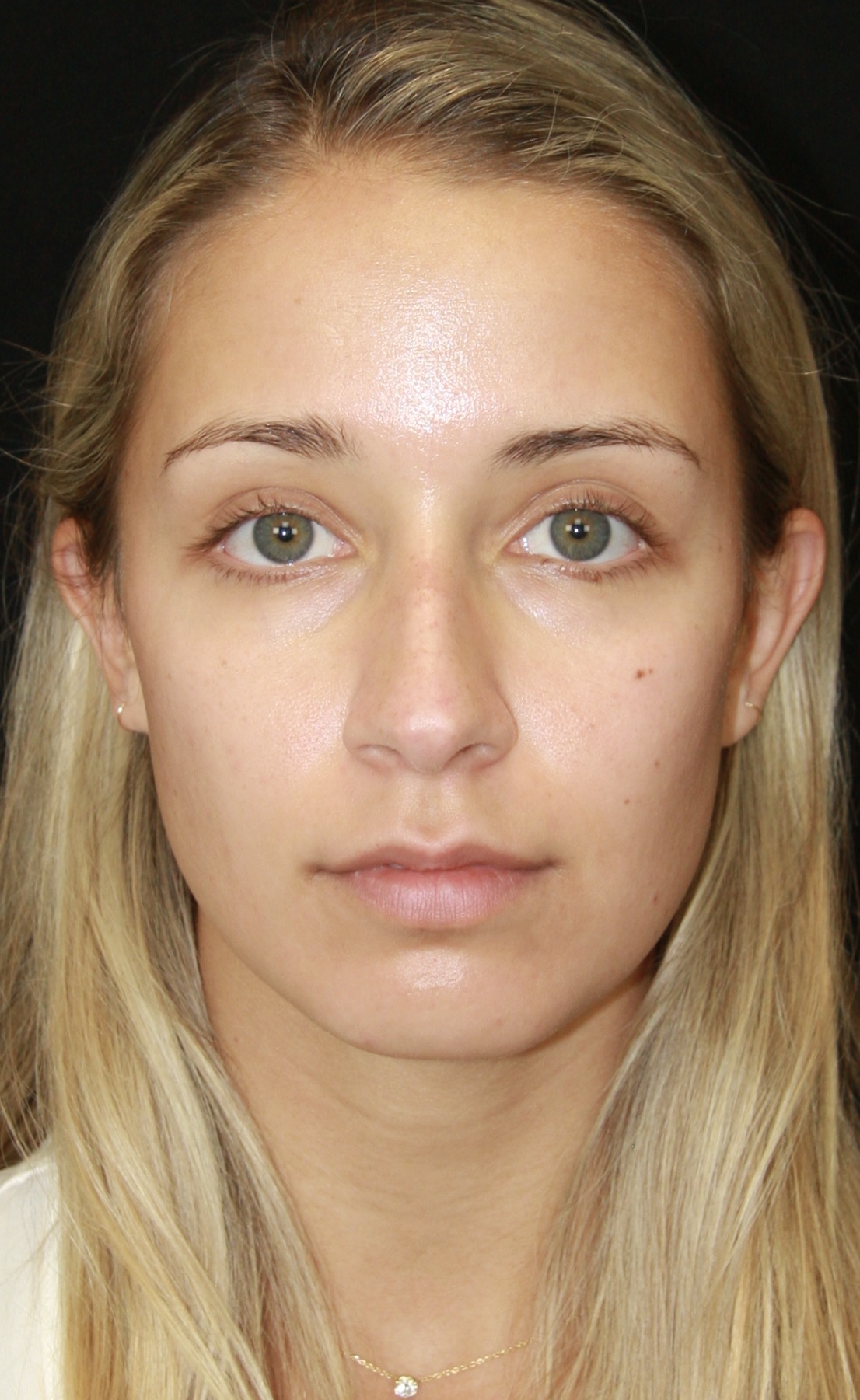 gal-image