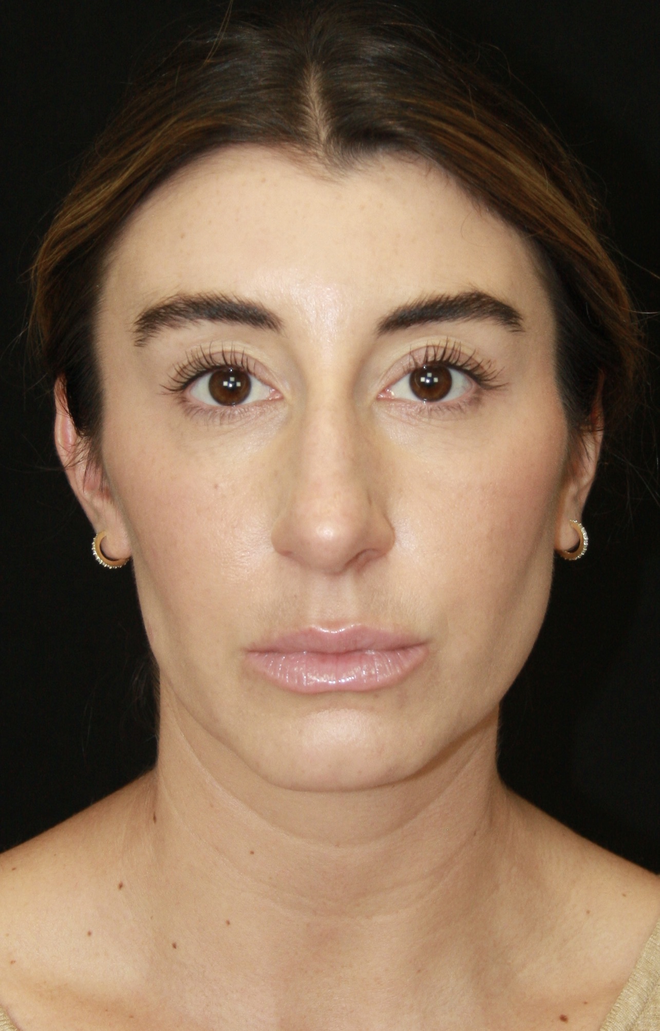 gal-image