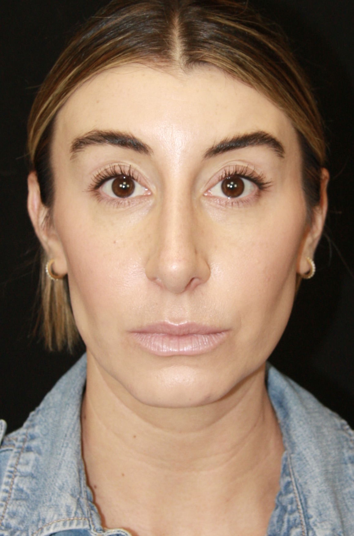 gal-image