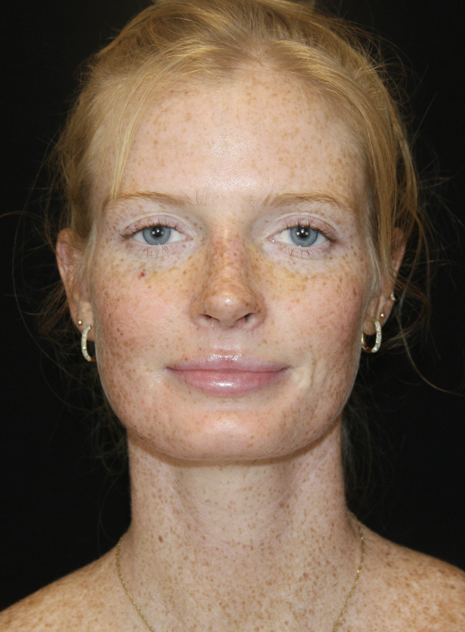 gal-image