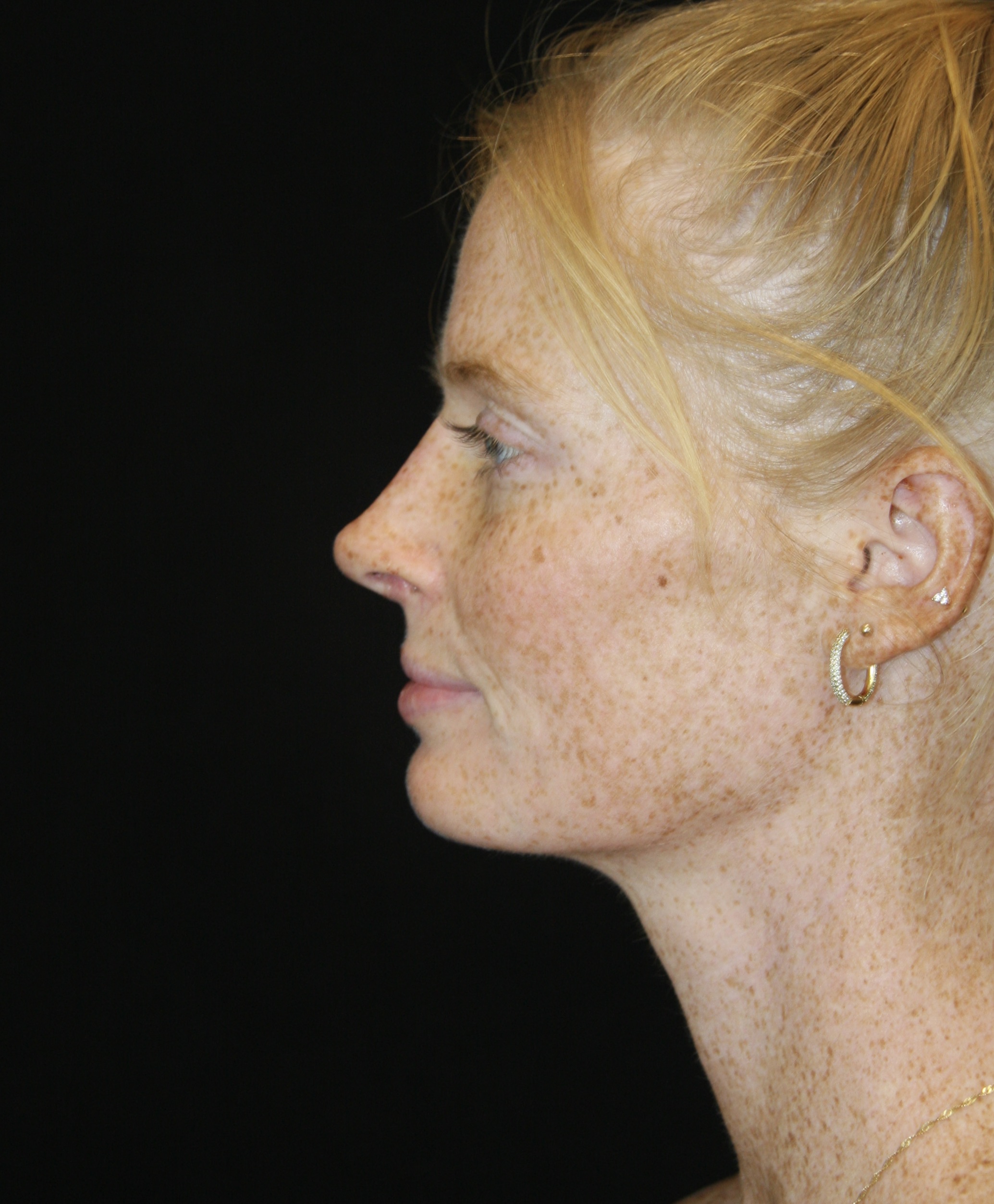 gal-image
