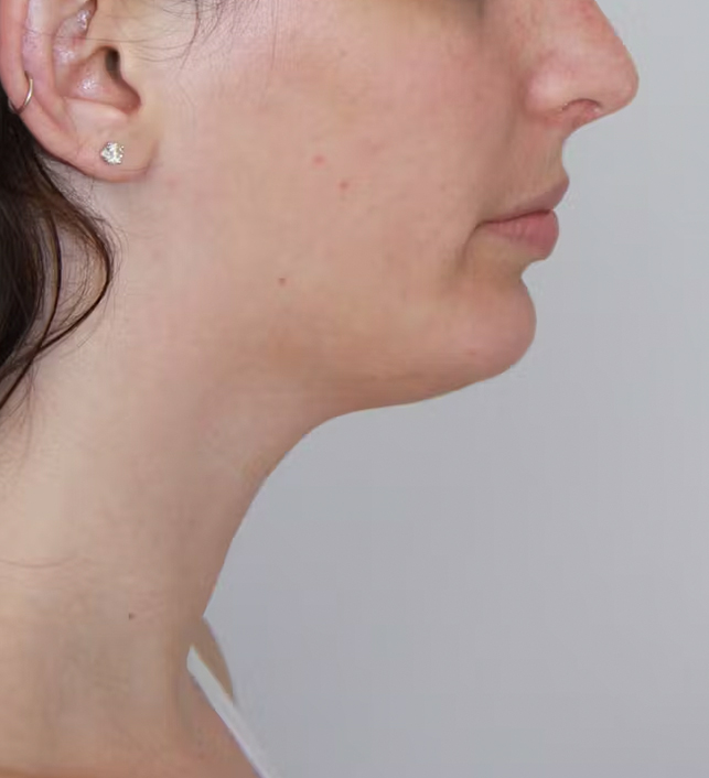gal-image