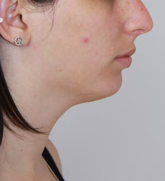 gal-image
