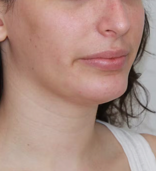 gal-image