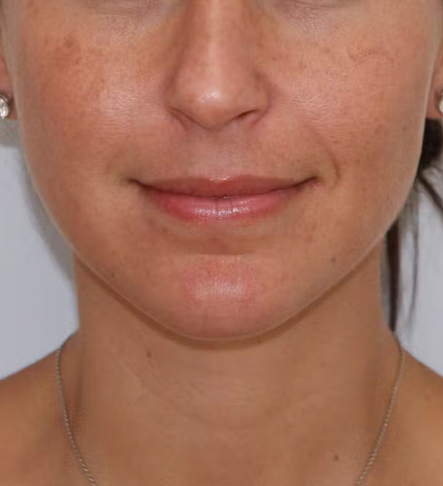 gal-image