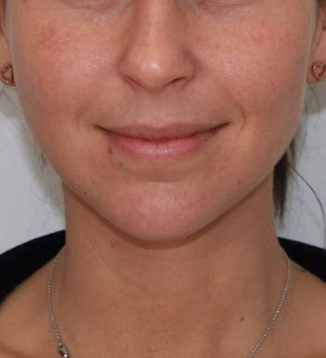 gal-image