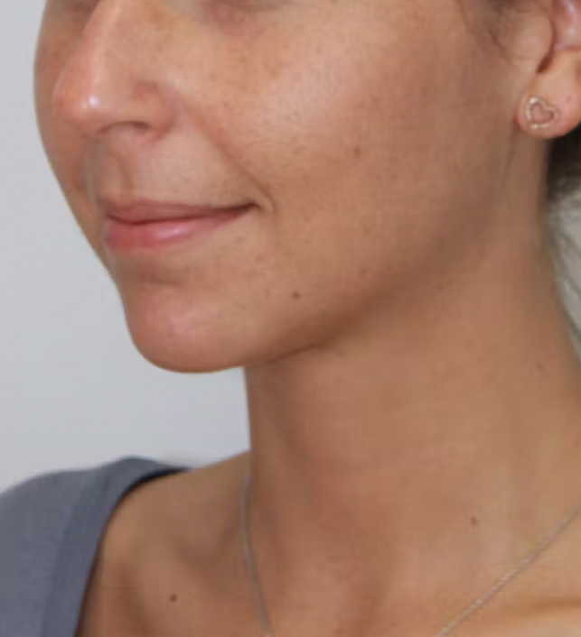 gal-image