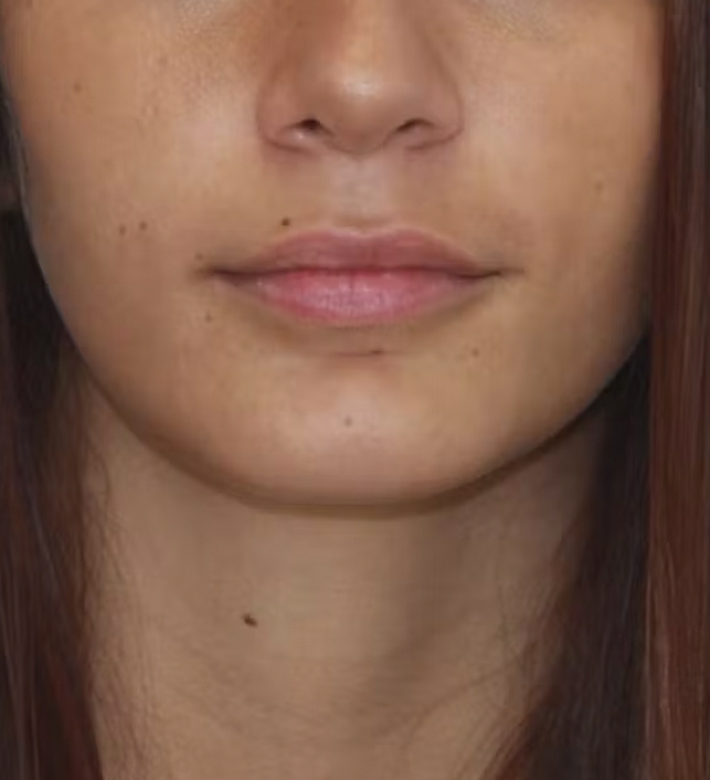 gal-image