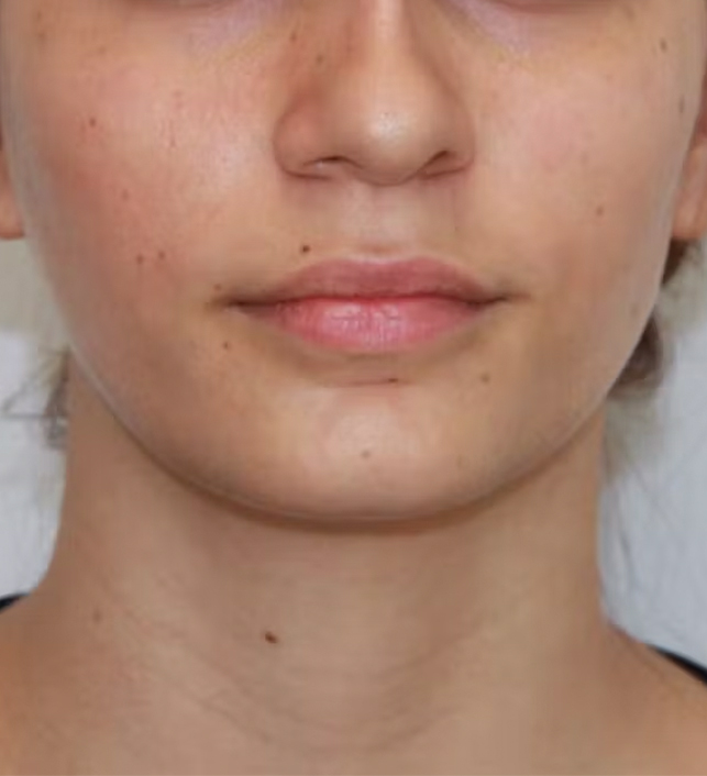 gal-image