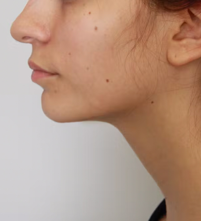 gal-image