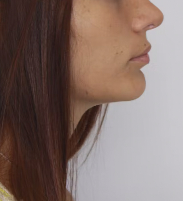 gal-image