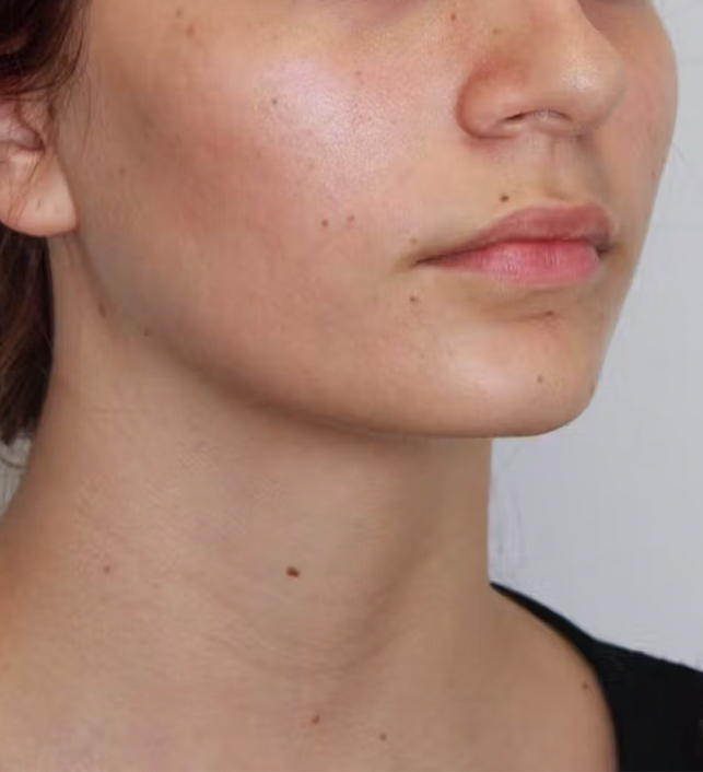 gal-image