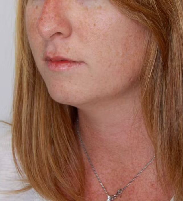 gal-image