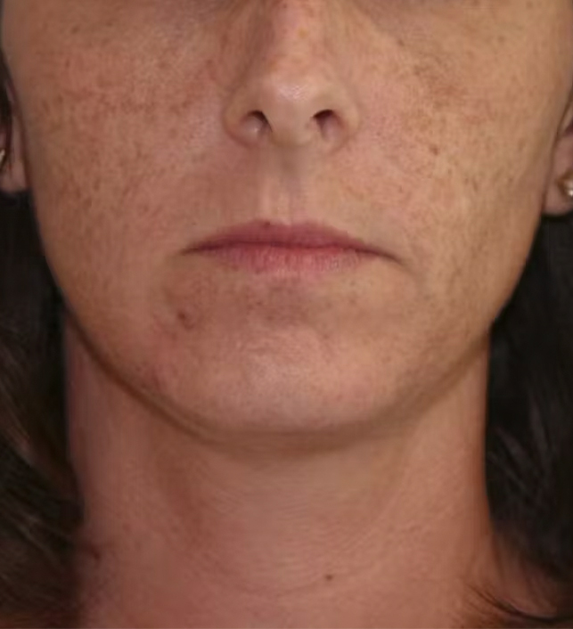 gal-image