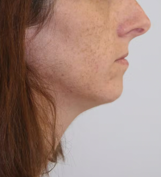 gal-image