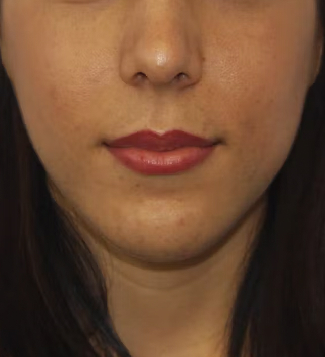 gal-image