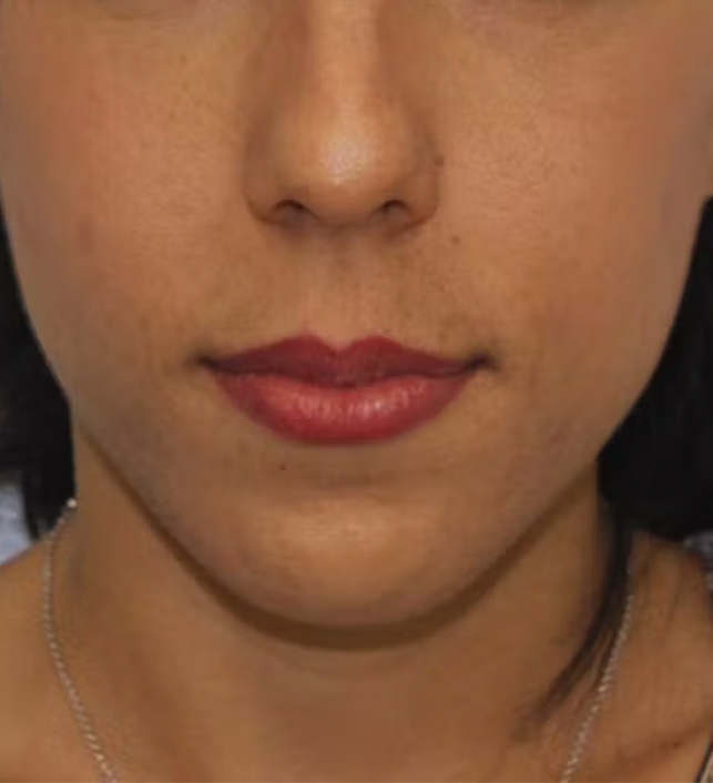 gal-image