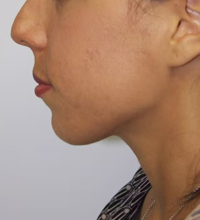 gal-image