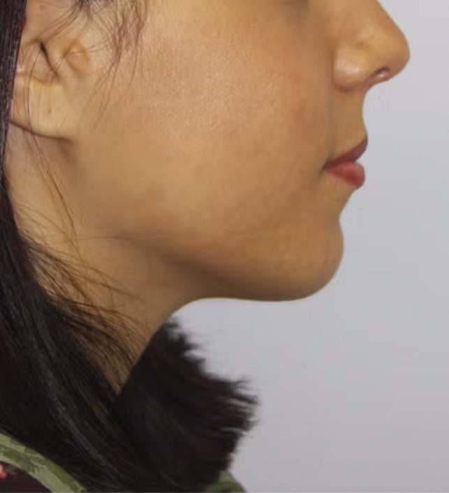 gal-image