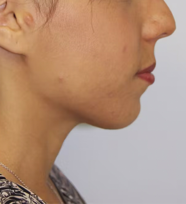 gal-image