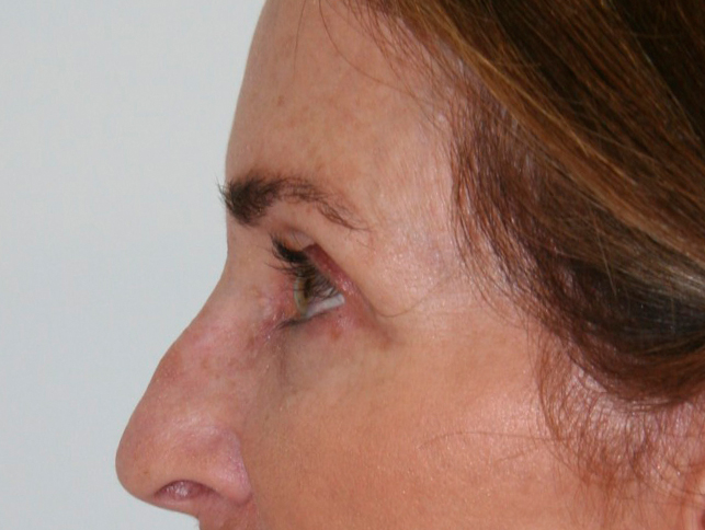 gal-image