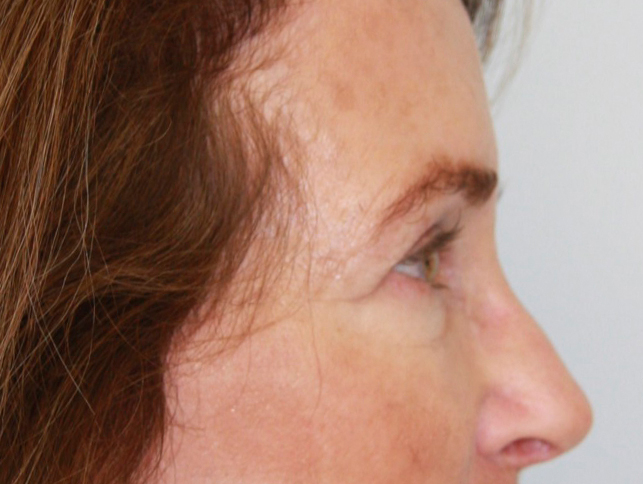 gal-image